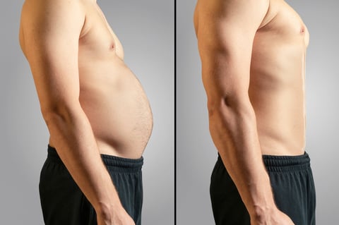 Overweight, Dieting, Change, Abdomen, Men